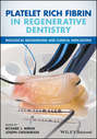 Platelet Rich Fibrin in Regenerative Dentistry